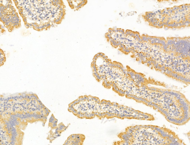 FBLIM1 Antibody in Immunohistochemistry (Paraffin) (IHC (P))