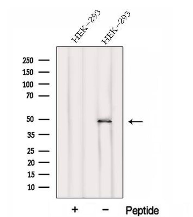 FBLIM1 Antibody in Western Blot (WB)