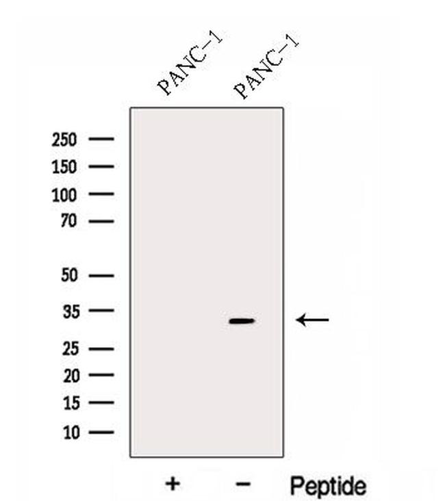 FBXO27 Antibody in Western Blot (WB)