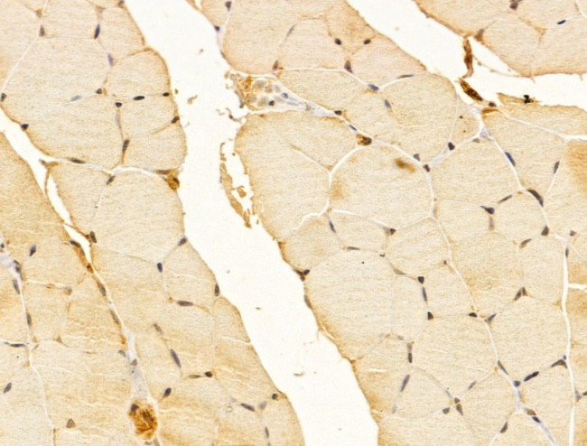 FZR1 Antibody in Immunohistochemistry (Paraffin) (IHC (P))