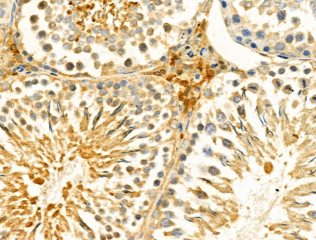 HSDL2 Antibody in Immunohistochemistry (Paraffin) (IHC (P))