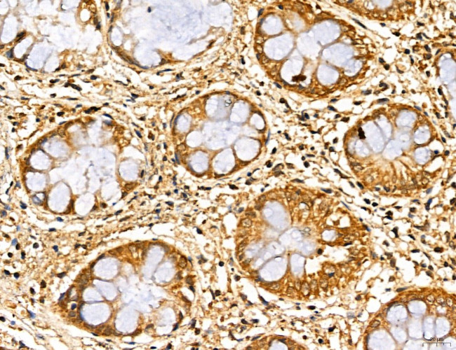 MAN1A2 Antibody in Immunohistochemistry (Paraffin) (IHC (P))