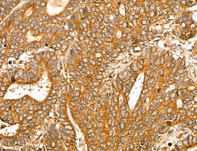 MAN1A2 Antibody in Immunohistochemistry (Paraffin) (IHC (P))