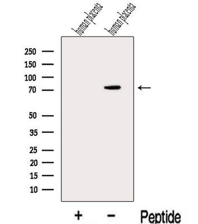 MAN1A2 Antibody in Western Blot (WB)