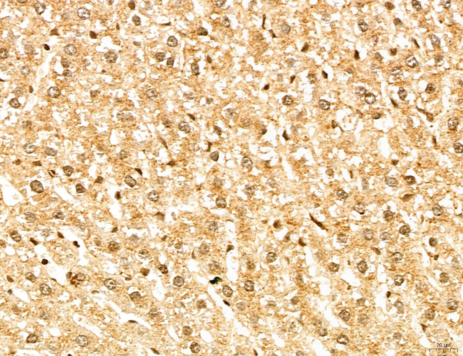 MAP1S Antibody in Immunohistochemistry (Paraffin) (IHC (P))