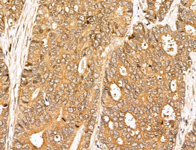 MAP1S Antibody in Immunohistochemistry (Paraffin) (IHC (P))