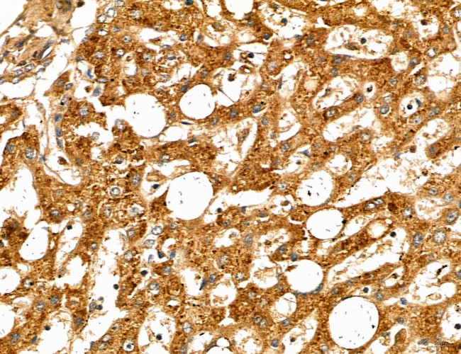 MAP1S Antibody in Immunohistochemistry (Paraffin) (IHC (P))