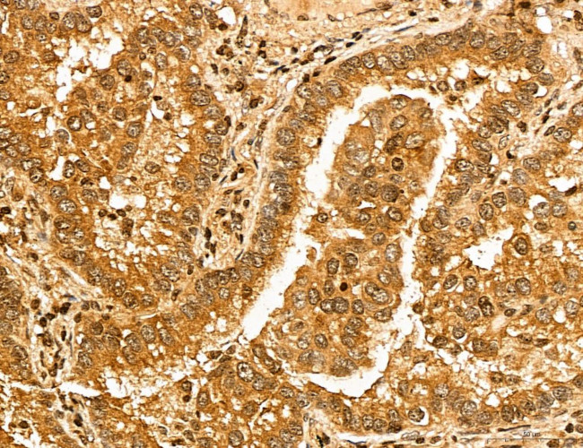 MAP1S Antibody in Immunohistochemistry (Paraffin) (IHC (P))