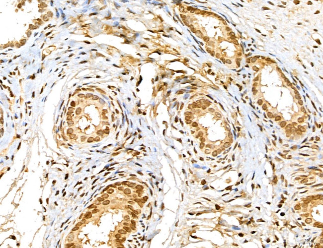 MAP1S Antibody in Immunohistochemistry (Paraffin) (IHC (P))