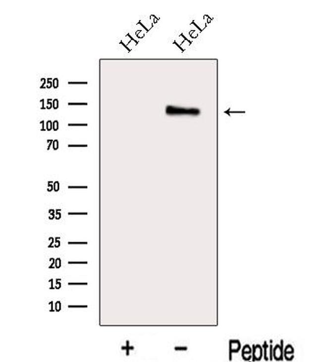 MAP1S Antibody in Western Blot (WB)