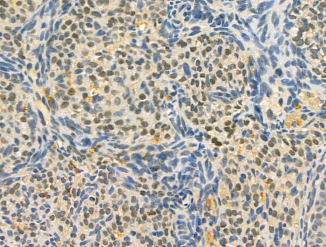 OBFC2B Antibody in Immunohistochemistry (Paraffin) (IHC (P))