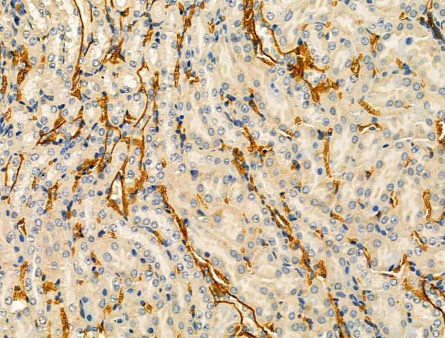 OSBPL10 Antibody in Immunohistochemistry (Paraffin) (IHC (P))