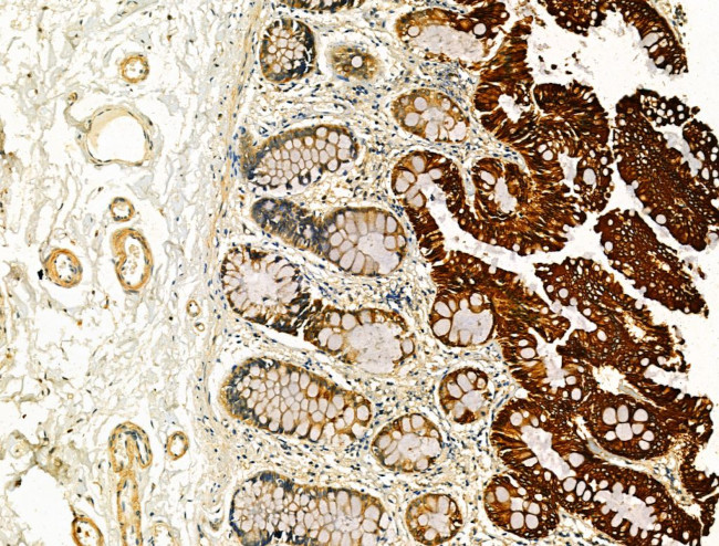 OSBPL10 Antibody in Immunohistochemistry (Paraffin) (IHC (P))