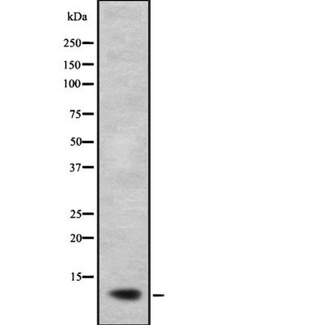 NDUFB2 Antibody in Western Blot (WB)