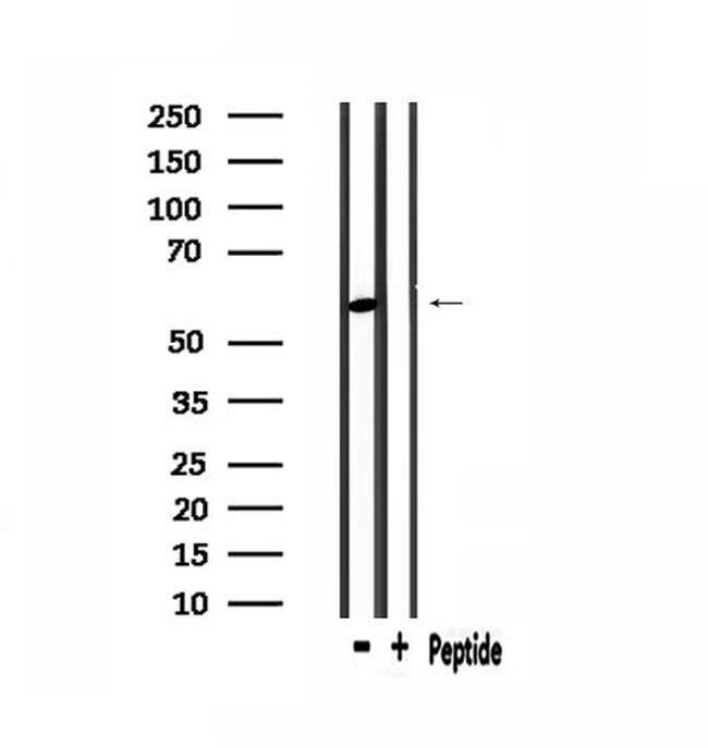 PDP2 Antibody in Western Blot (WB)