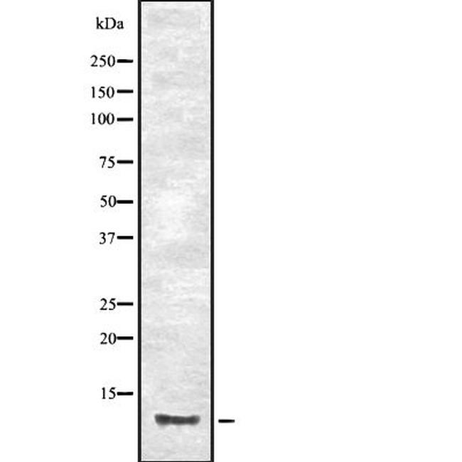 CCL23 Antibody in Western Blot (WB)