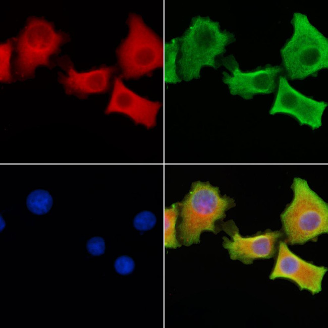 SLC34A2 Antibody in Immunocytochemistry (ICC/IF)