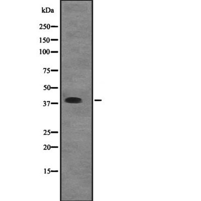 eIF2b beta Antibody in Western Blot (WB)