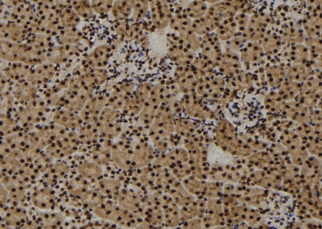 CENPF Antibody in Immunohistochemistry (Paraffin) (IHC (P))