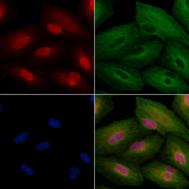 ZSCAN2 Antibody in Immunocytochemistry (ICC/IF)