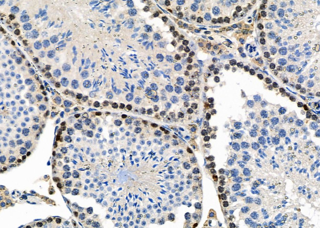 EBNA1BP2 Antibody in Immunohistochemistry (Paraffin) (IHC (P))