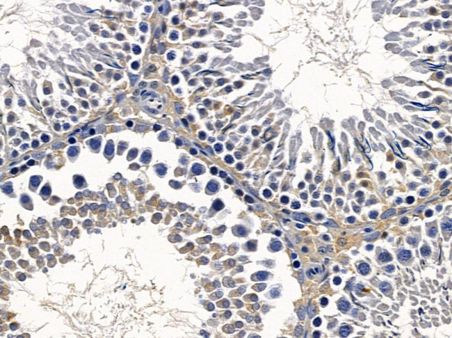 MOB1 Antibody in Immunohistochemistry (Paraffin) (IHC (P))