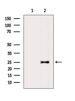 MOB1 Antibody in Western Blot (WB)