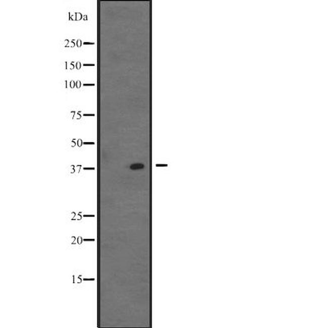 VSX1 Antibody in Western Blot (WB)