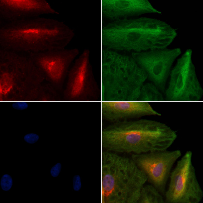 IL36B Antibody in Immunocytochemistry (ICC/IF)