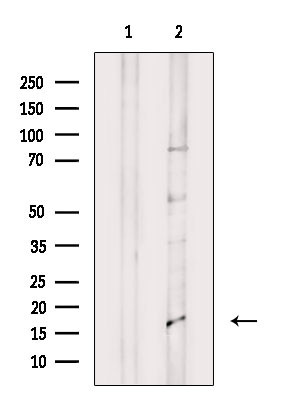 IL36B Antibody in Western Blot (WB)