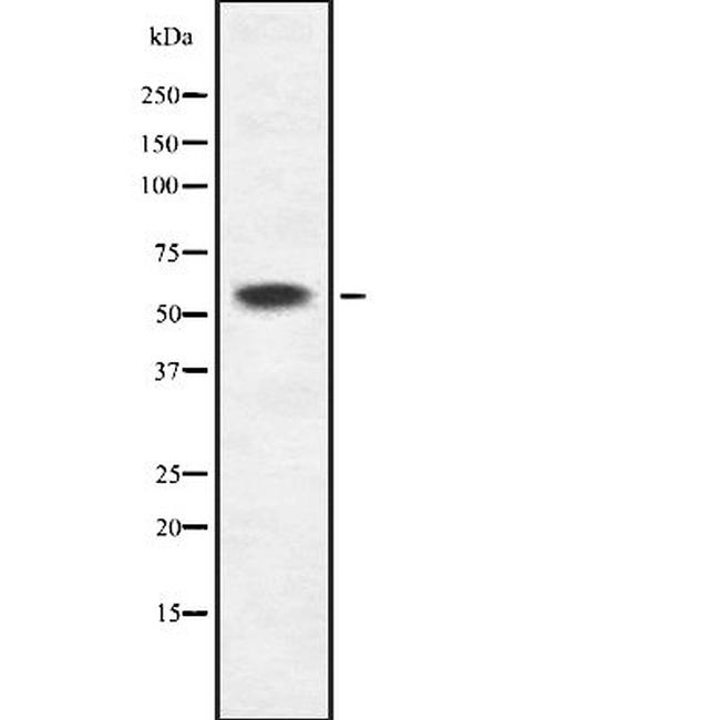 KRT6B/KRT6C Antibody in Western Blot (WB)