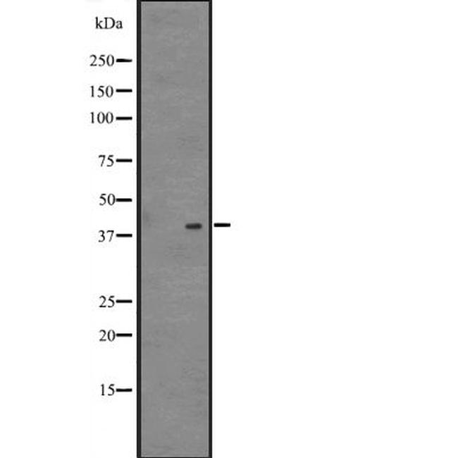 NDFIP2 Antibody in Western Blot (WB)