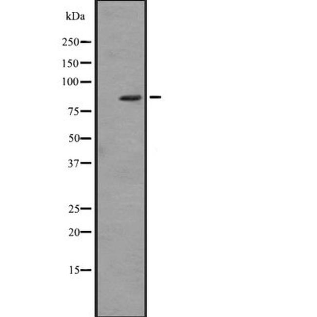 ZBTB16 Antibody in Western Blot (WB)