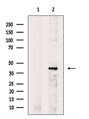 CSNK2A2 Antibody in Western Blot (WB)