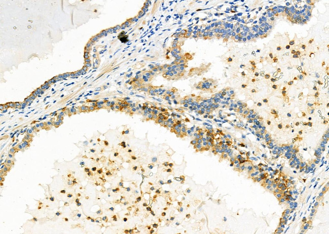 TRIO Antibody in Immunohistochemistry (Paraffin) (IHC (P))