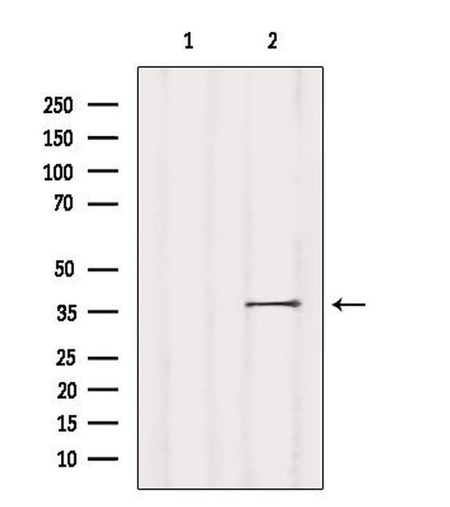 NPBWR1 Antibody in Western Blot (WB)