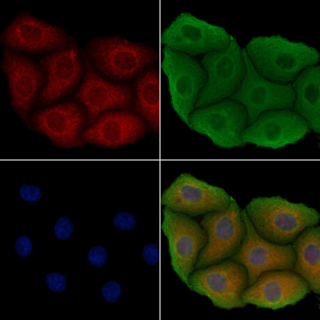 LPAR5 Antibody in Immunocytochemistry (ICC/IF)