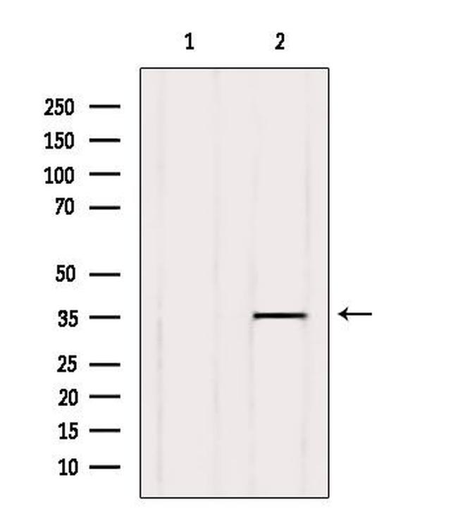 GPR141 Antibody in Western Blot (WB)