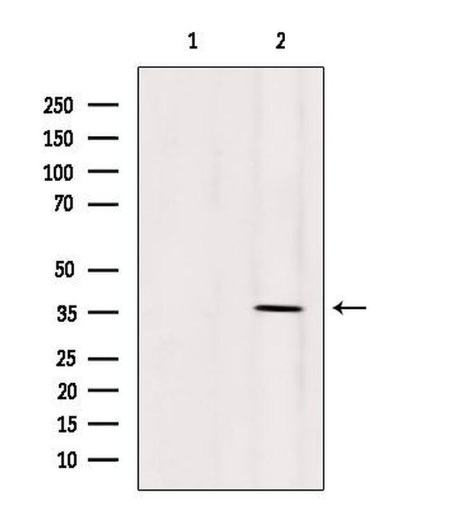OR5AN1 Antibody in Western Blot (WB)