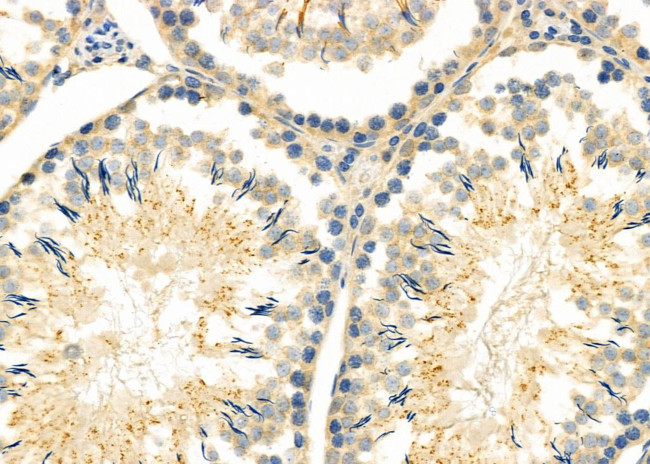 Enkurin Antibody in Immunohistochemistry (Paraffin) (IHC (P))