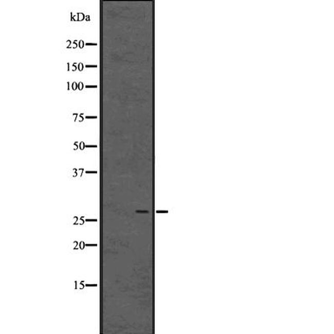 Enkurin Antibody in Western Blot (WB)