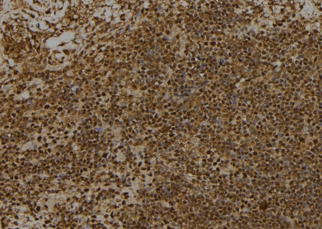 Phospho-RSK1 (Thr359, Ser363) Antibody in Immunohistochemistry (Paraffin) (IHC (P))