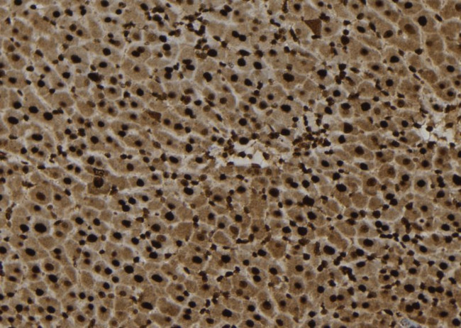 PIK3R2 Antibody in Immunohistochemistry (Paraffin) (IHC (P))