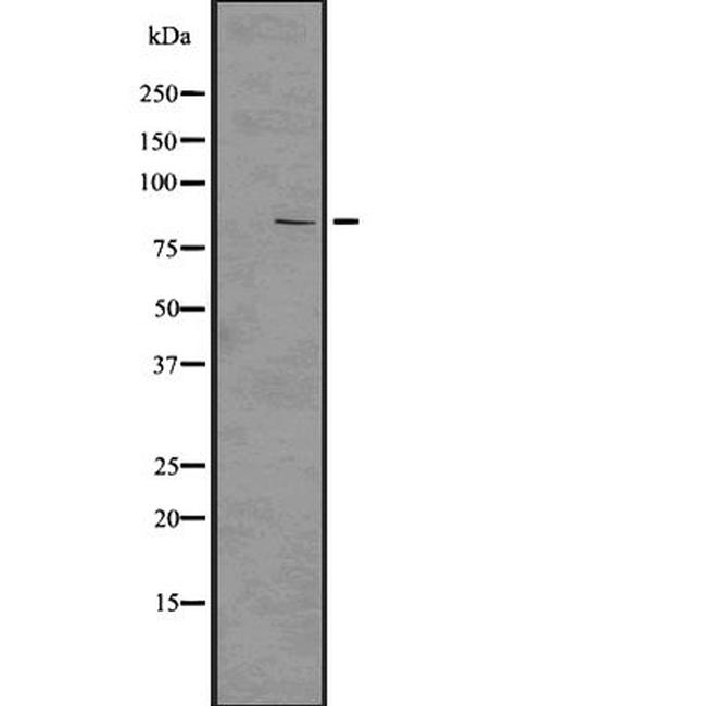 PIK3R2 Antibody in Western Blot (WB)