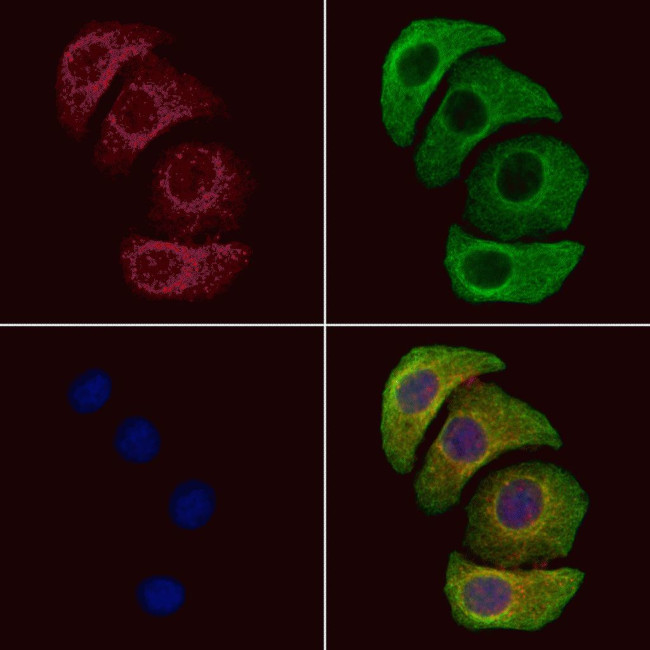 Phospho-PKM2 (Tyr105) Antibody in Immunocytochemistry (ICC/IF)