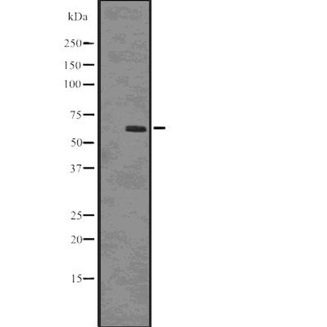 Phospho-SQSTM1 (Ser403) Antibody in Western Blot (WB)