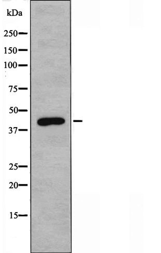 DLX3 Antibody in Western Blot (WB)