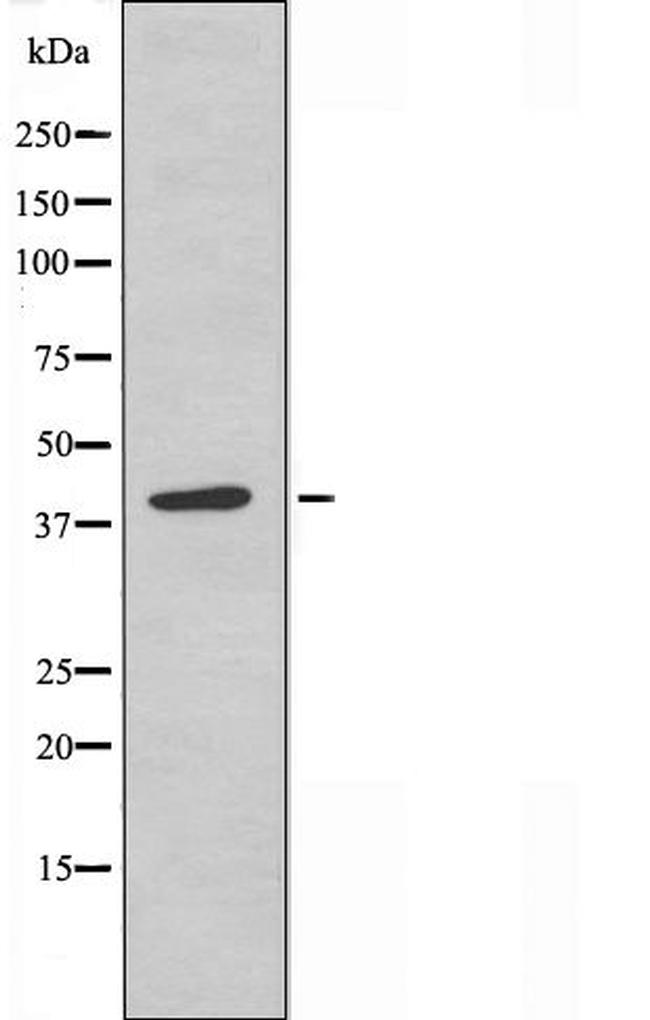 LMX1B Antibody in Western Blot (WB)