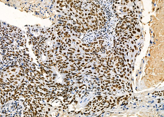 PRKAR1B Antibody in Immunohistochemistry (Paraffin) (IHC (P))