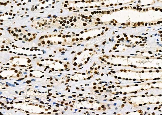 PRKAR1B Antibody in Immunohistochemistry (Paraffin) (IHC (P))